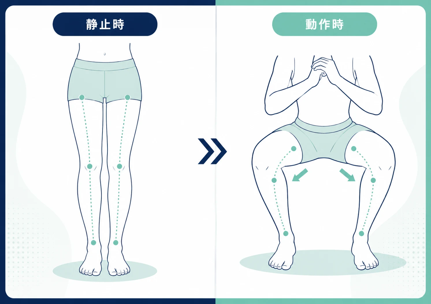 静止時と動作時の膝アライメント比較